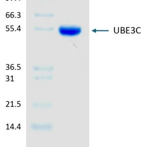Active, Human, Recombinant UBE3C