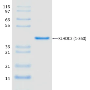 Active, Recombinant Human KLHDC2 (1-360)