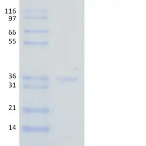 Recombinant Human Ubiquitin, K11 Only