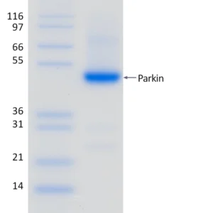 Active, Recombinant Human Parkin