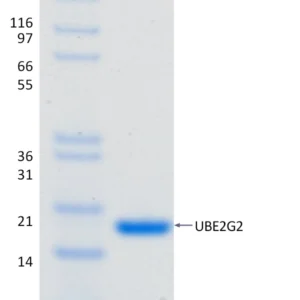 Active, Recombinant Human UBE2G2